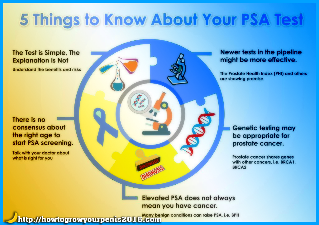 Prostate Specific Antigen test