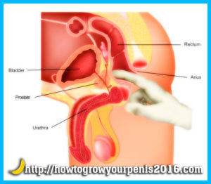 digital rectal exam